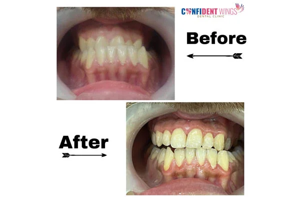 Orthodontic Case