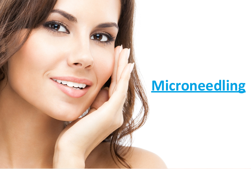 Microneedling